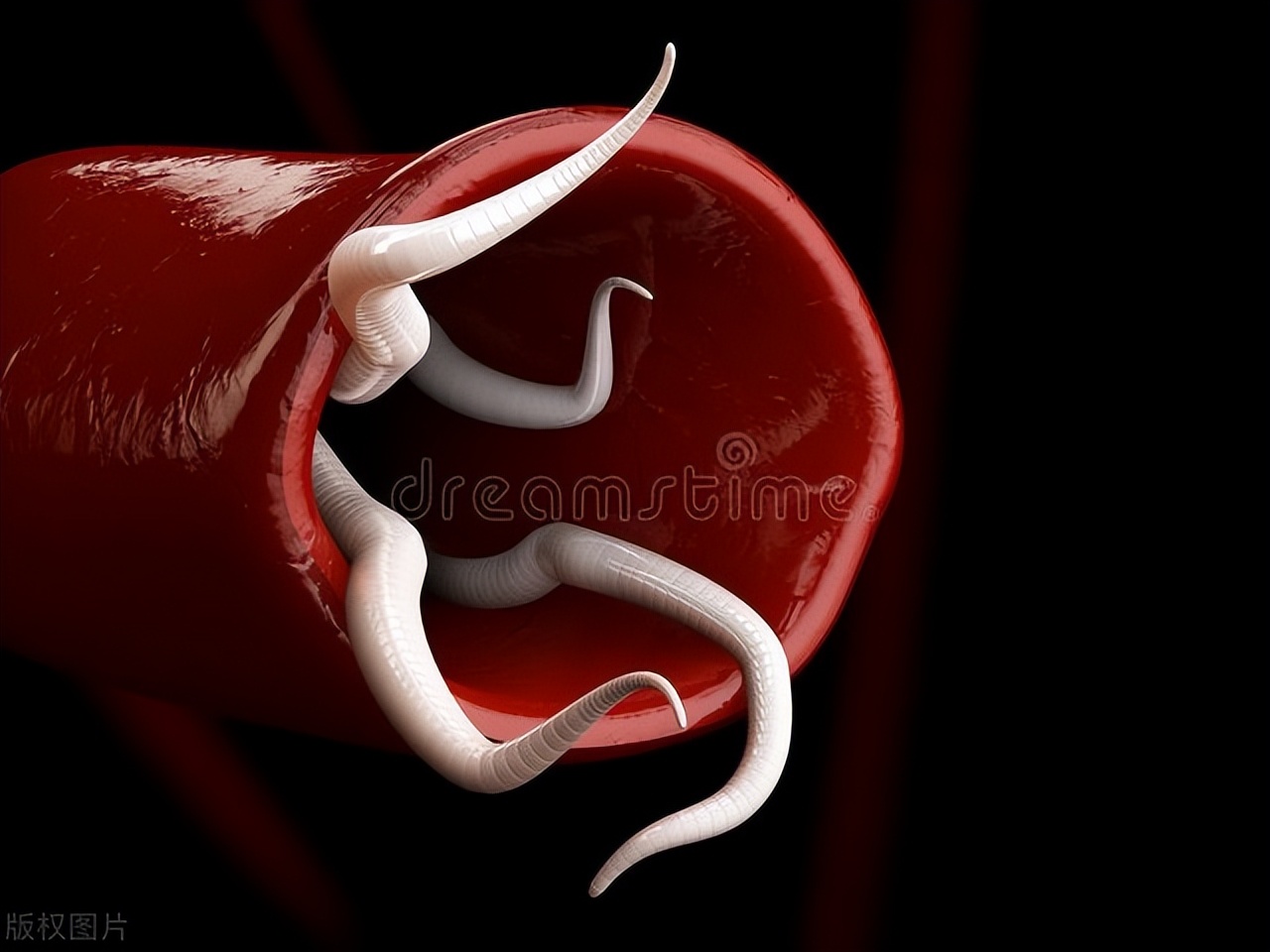 几十年前肚子有蛔虫怎么办,几十年前肚里蛔虫为什么没有了