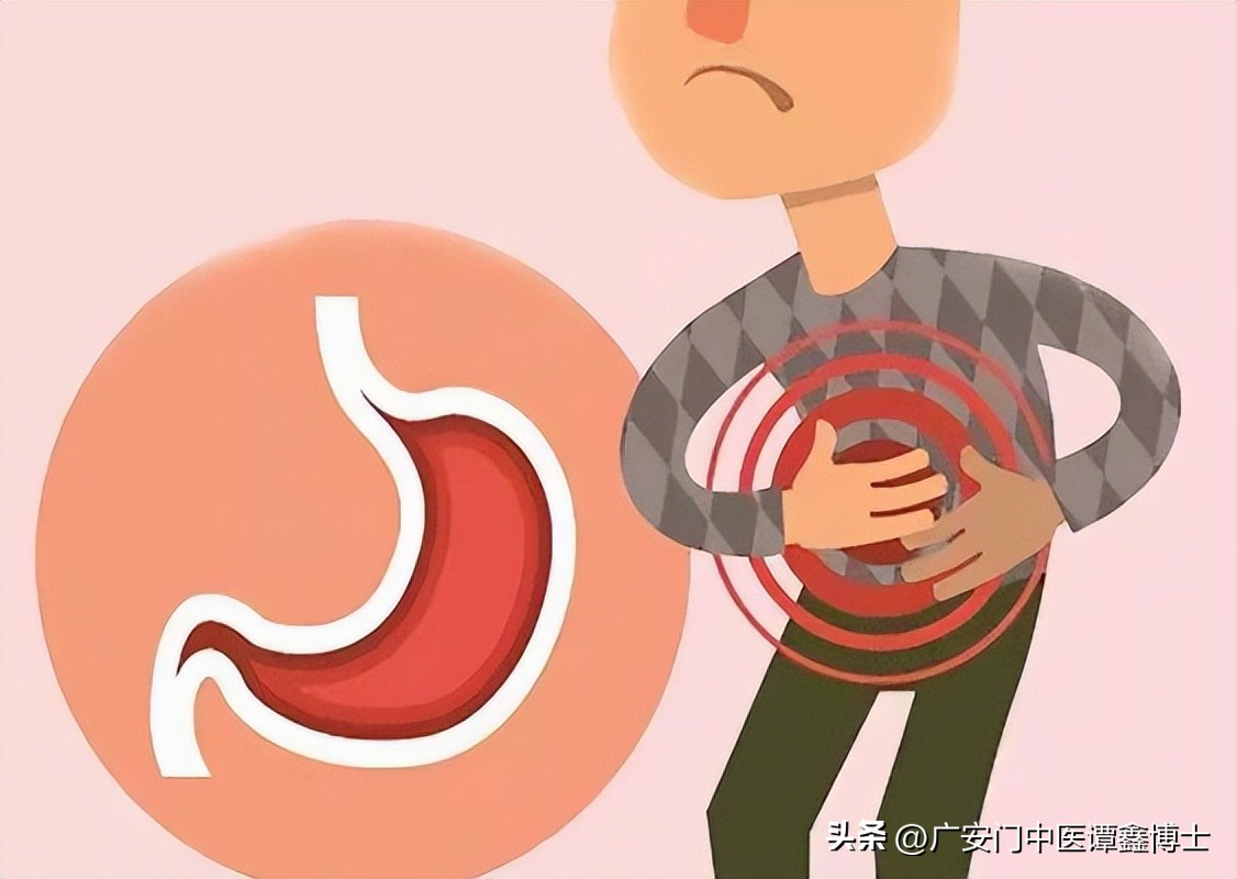 胃溃疡有可能转为胃癌吗,胃溃疡演变成癌症的几率多大