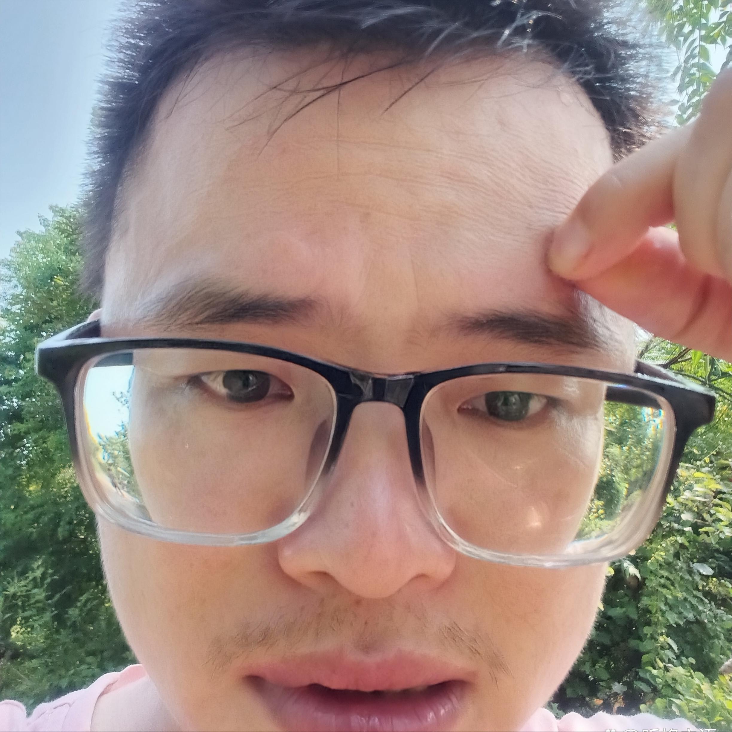 蜜蜂蛰了额头留下一片黑怎么办,我被蜜蜂蛰了