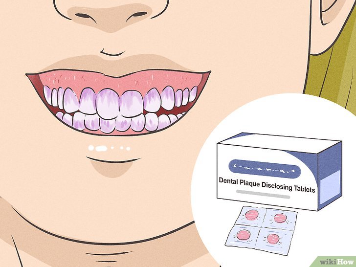 如何有效去除牙菌斑清洁口腔,牙线怎么清除牙菌斑