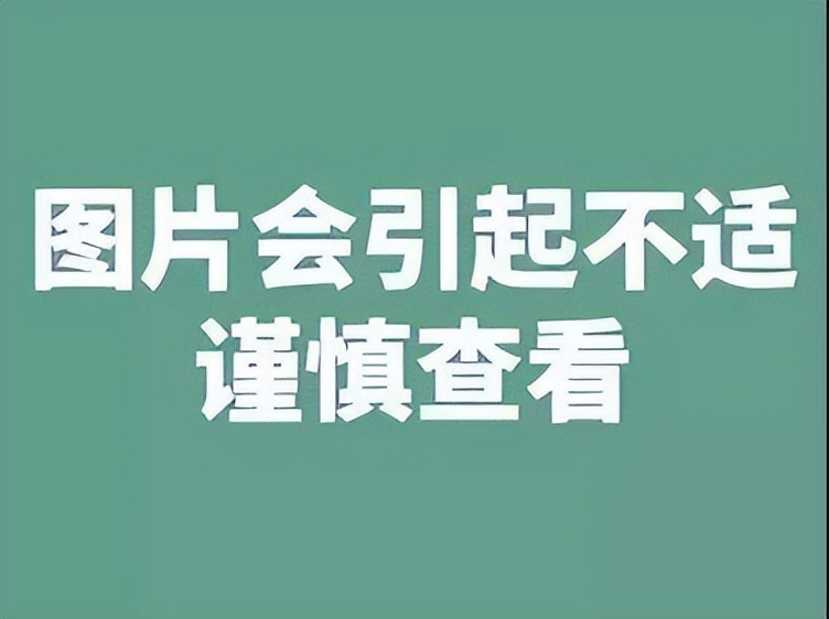切完肠息肉需要吃什么药,切胃肠息肉后怎样复查