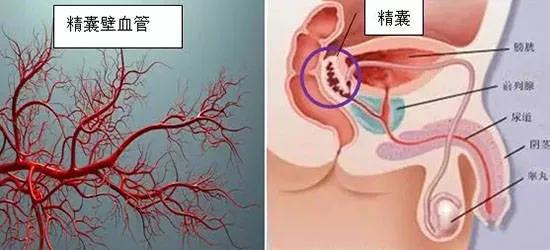 精子带血为细菌性前列腺炎吗,精子带血是不是梅毒