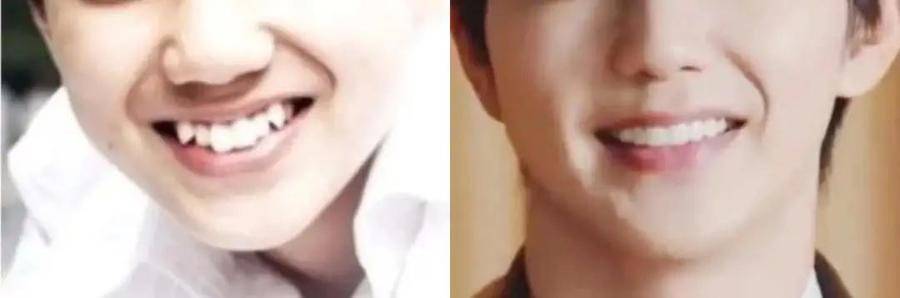 国民初恋毁容了,国民初恋盛世美颜