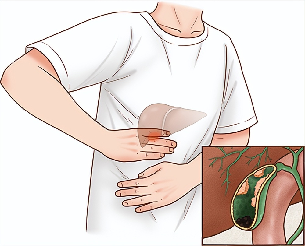 体检发现有息肉，离癌症还有多远？我彻底方了...