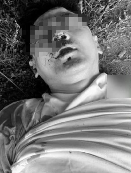 林志颖开特斯拉车祸后伤势严重!面部骨折做整容手术,儿子受惊吓