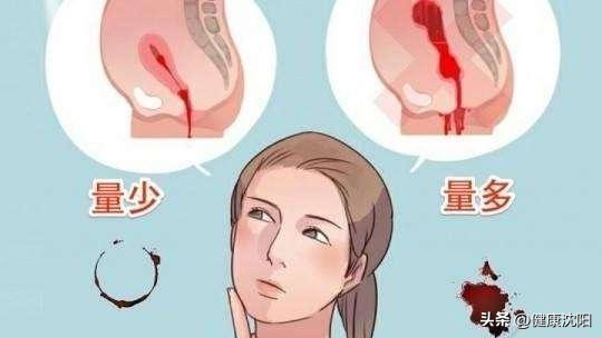 月经不调科普视频讲解,月经不调的健康宣教