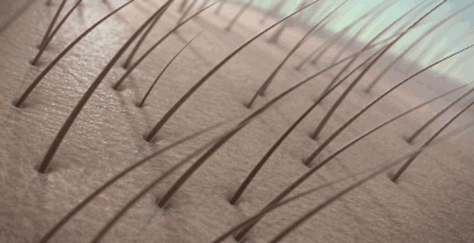 控油防秃头洗发水推荐,修护受损发质防脱洗发水推荐