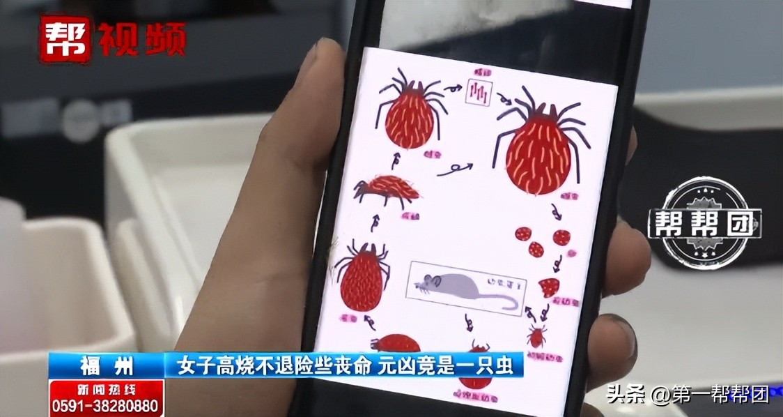 女子被恙虫叮咬持续高烧40度,福建被虫子咬到哪里医院好