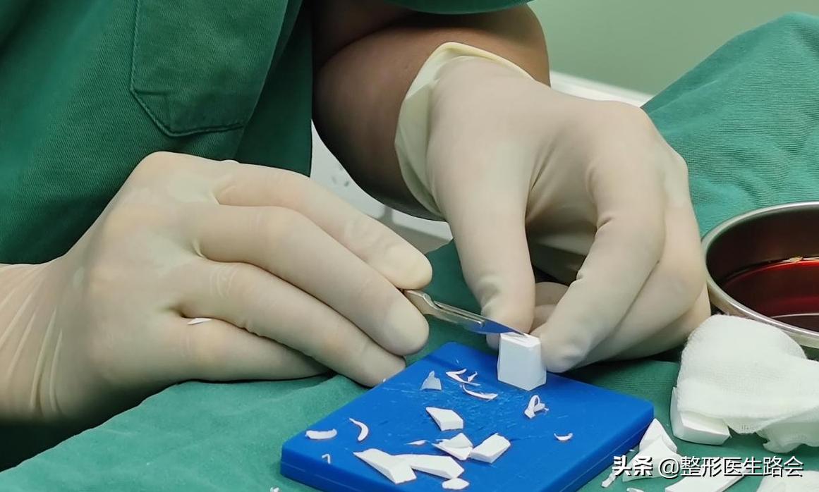 脸部整形手术成功案例,全脸整形耗时