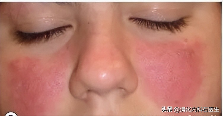 女子腹痛多年被误诊,女子腹痛多年一直被误诊