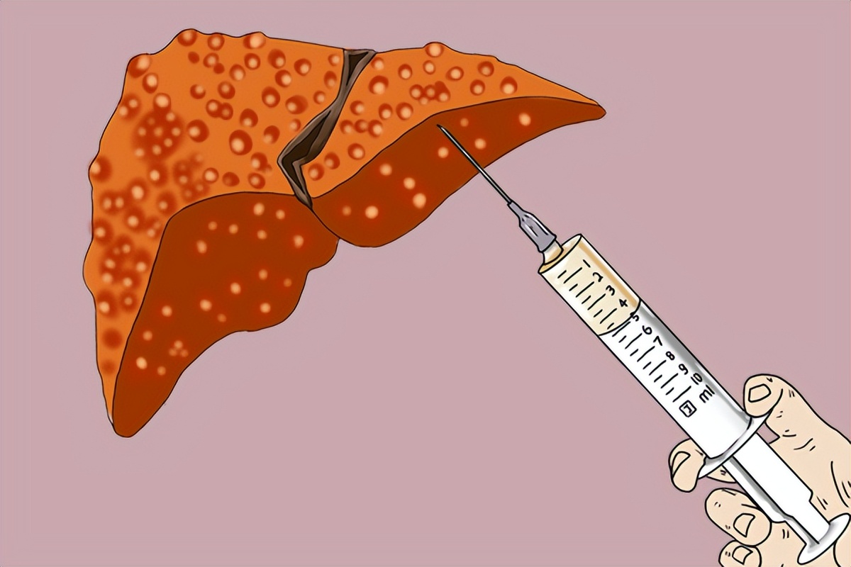 一针杀死癌细胞120万针对哪种癌症,120万干细胞能治疗肝癌吗
