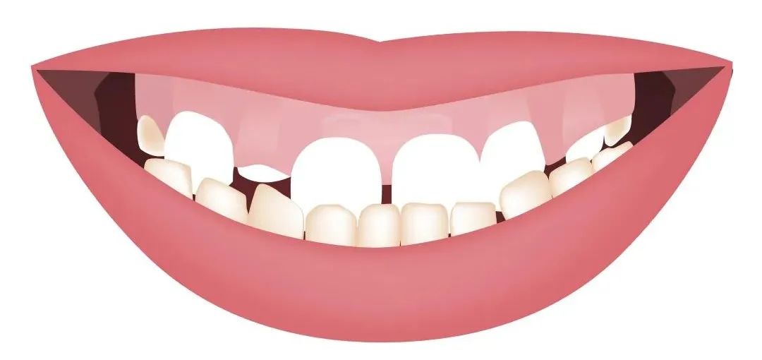 成年女性睡觉磨牙的危害,磨牙后戴假牙有什么危害