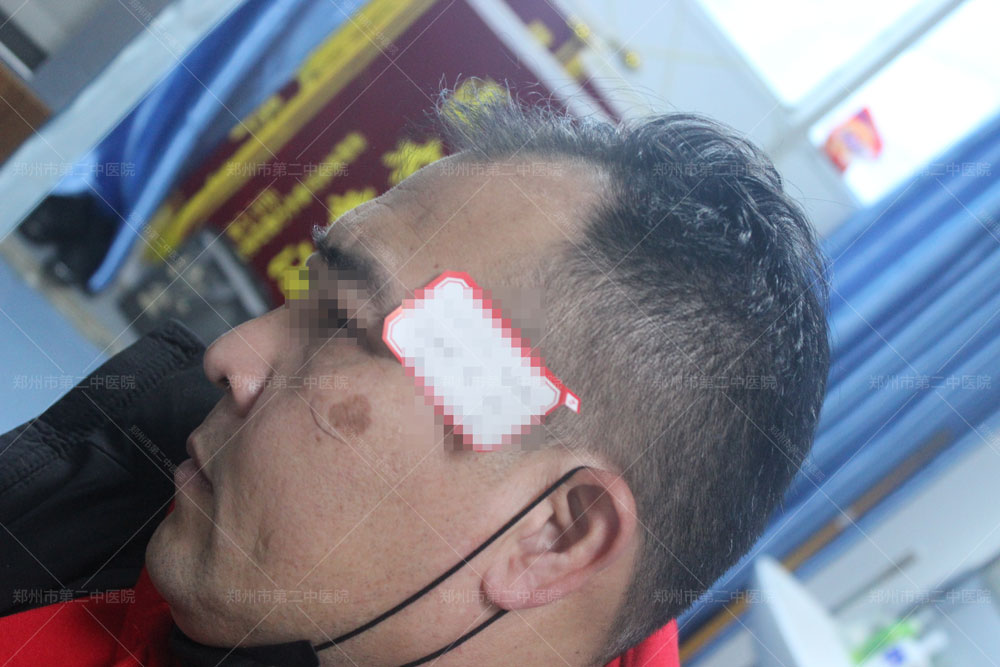 郑州市第二中医院：疤痕色素沉着怎么去除？