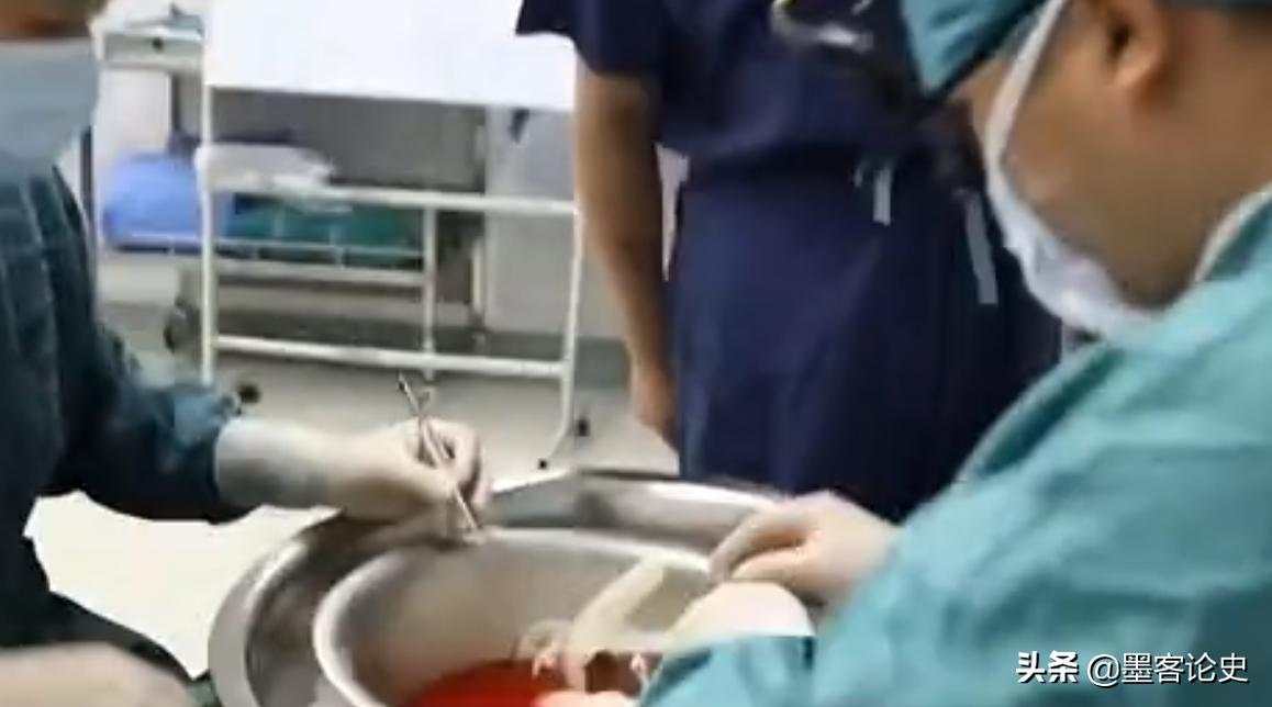 癌症晚期内蒙古小伙,53岁大叔肝肿瘤