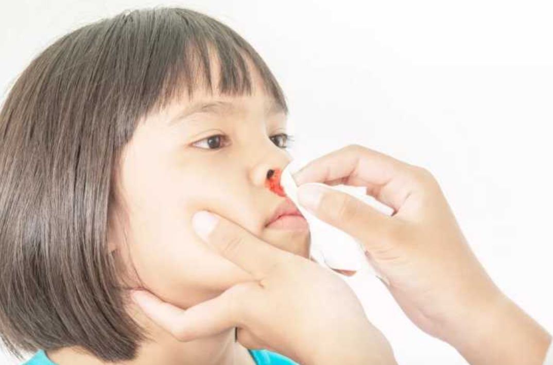 孩子碰伤流鼻血,妈妈“两拒绝一动作”救了娃,医生:不用去医院