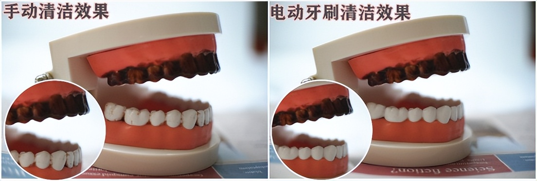 杂牌电动牙刷的危害,电动牙刷的危害有哪些