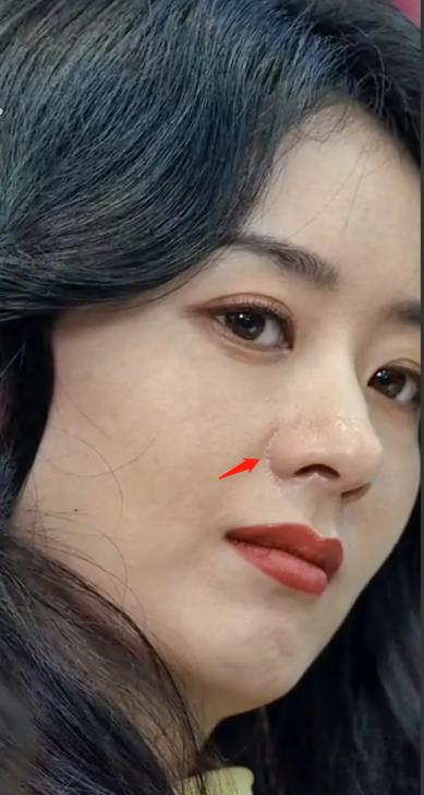 完美女神根本不存在！死皮、黑头、痘痘、毛孔…怼脸暴露真实颜值