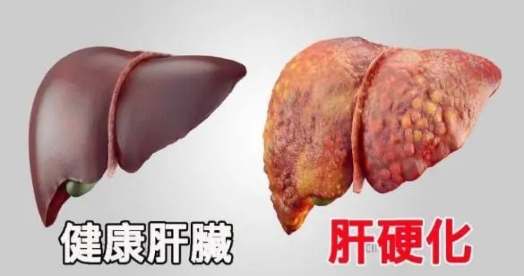 身上出现小红点是怎么回事没感觉,身上出现大面积小红点不痛不痒的