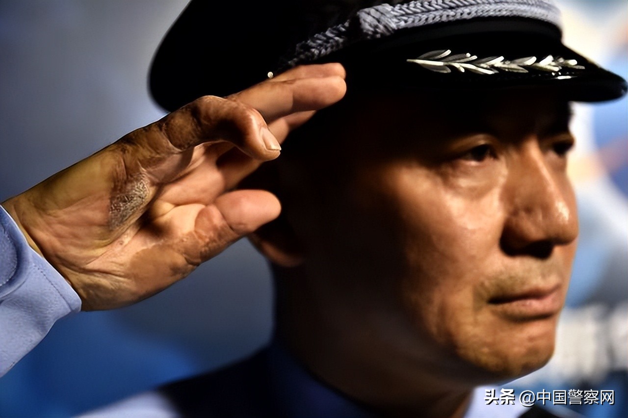 【践行总要求·总书记的话激励我奋进】张保国：伤疤是最美的勋章