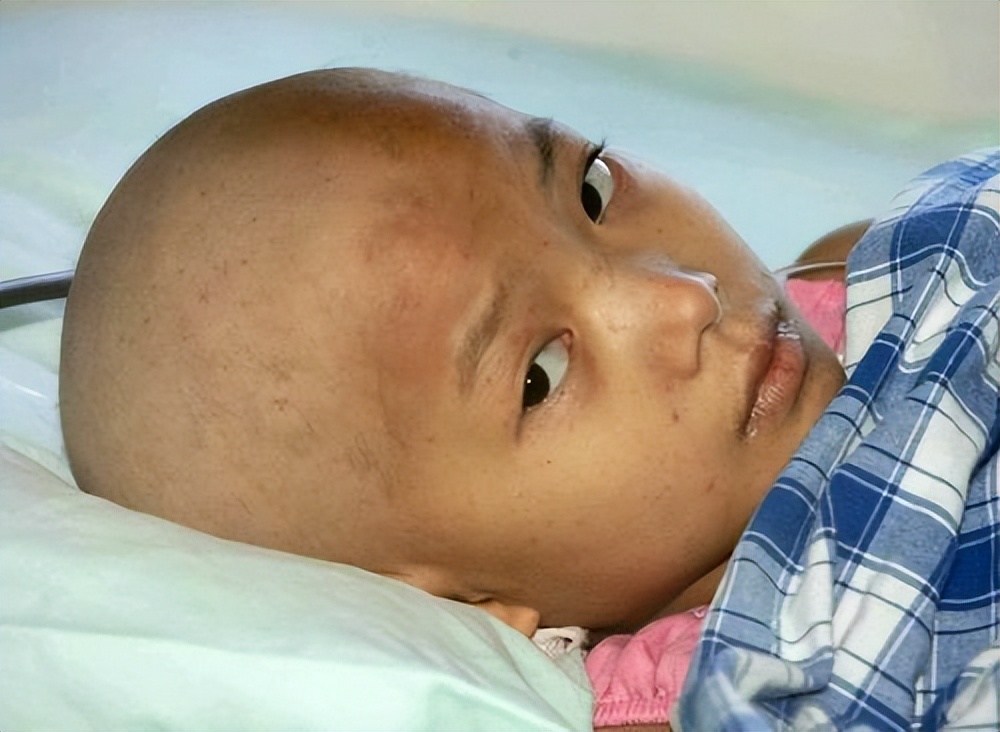 18岁患癌女孩临终遗言,女孩患癌18年一直坚持治愈成功