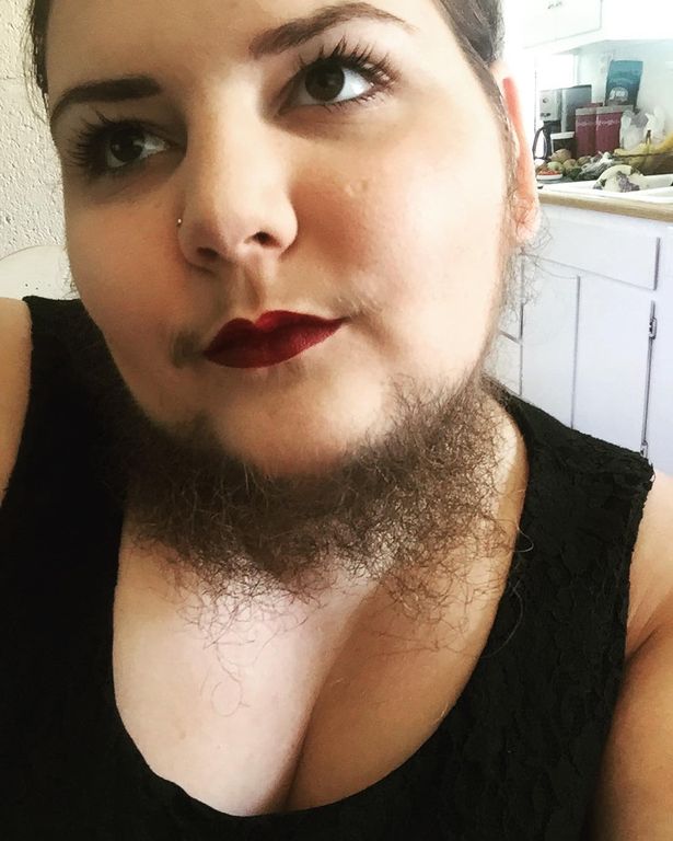 13岁的小女孩长胡子正常吗,13岁女孩长很多胡子