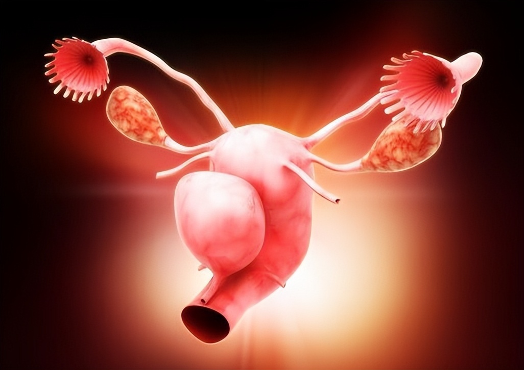 10年没治疗，子宫肌瘤长到4斤，如6个月的婴儿！手术取出109颗