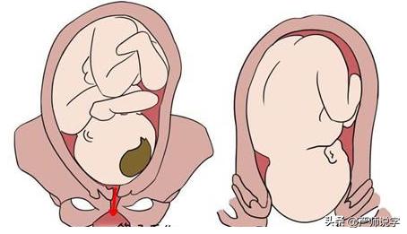 汉字偏旁部首大全及名称表打印,汉字的偏旁部首大全完整版pdf