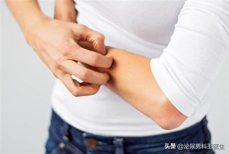阴虱是什么？为什么现在很多人得阴虱？医生：离不开3个传播途径