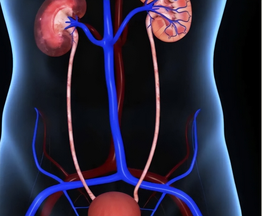 尿液柠檬黄是什么原因引起的,尿液黄泡沫多是什么原因