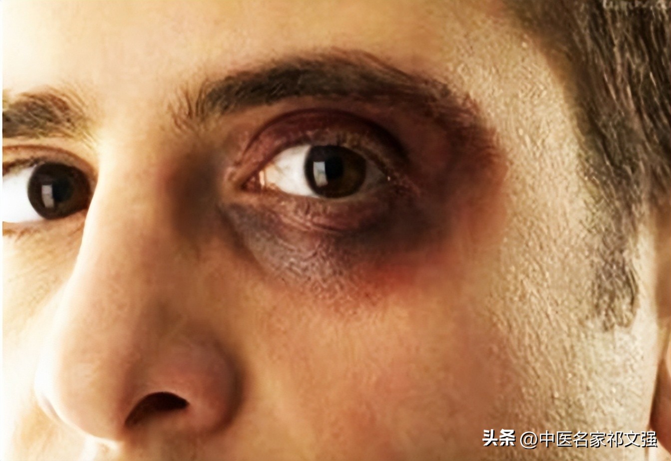 化水利湿法治愈面部黧黑