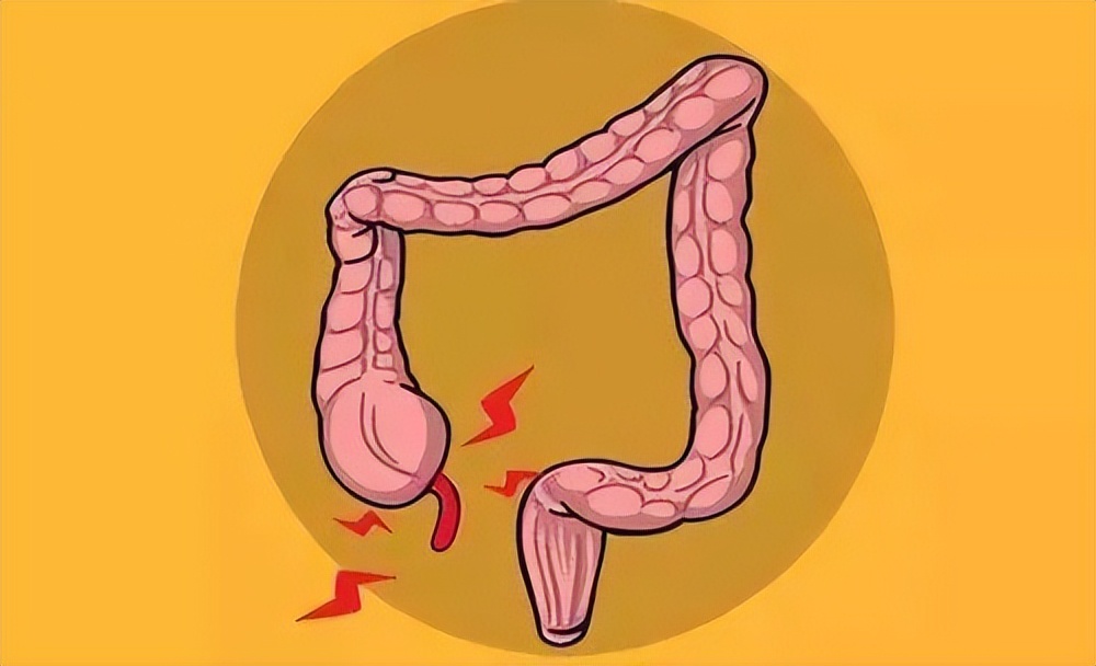 腹痛,是阑尾还是胃肠炎?