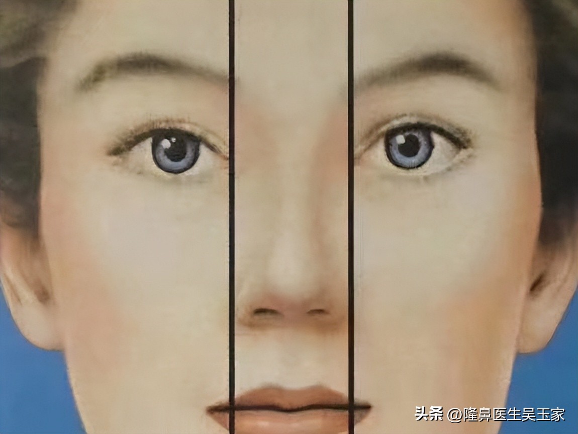 鼻头大整容前后男,鼻头肥大鼻翼宽做手术