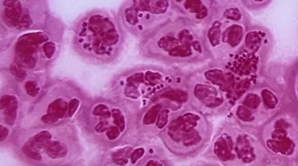 公共厕所马桶到底有多脏,使用公共马桶会感染疾病么