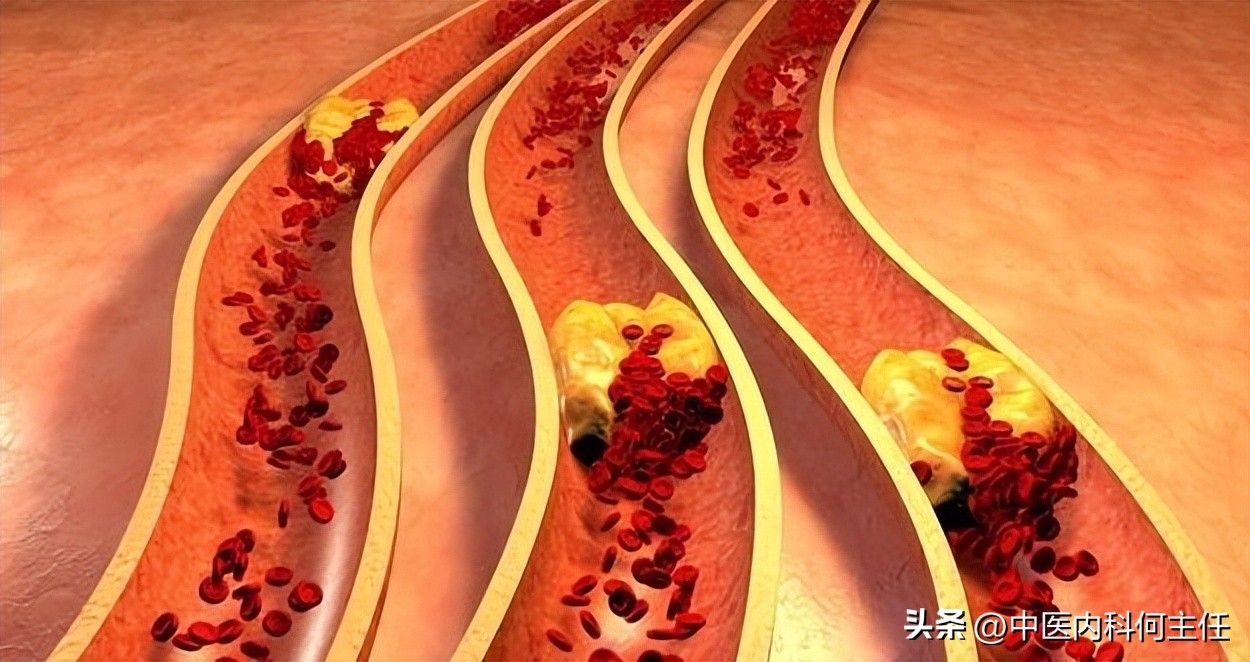 治疗眩晕，这里有一个妙方，特别适合舌头白腻的人使用！