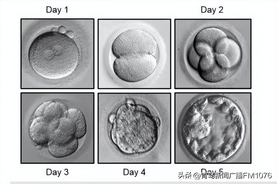 揭秘试管婴儿孕育全过程,试管婴儿诞生原理