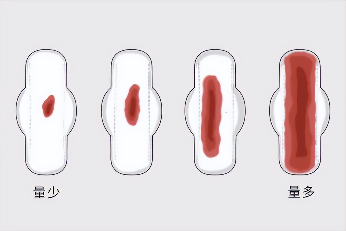 人流后身体会有什么变化,做完人流身体会有哪些变化