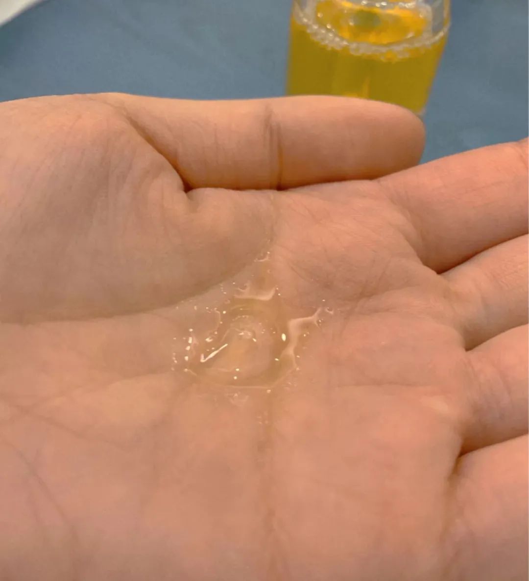 lamer海蓝之谜新生活肤精华油30ml,海蓝之谜焕活精华油适合油痘肌吗