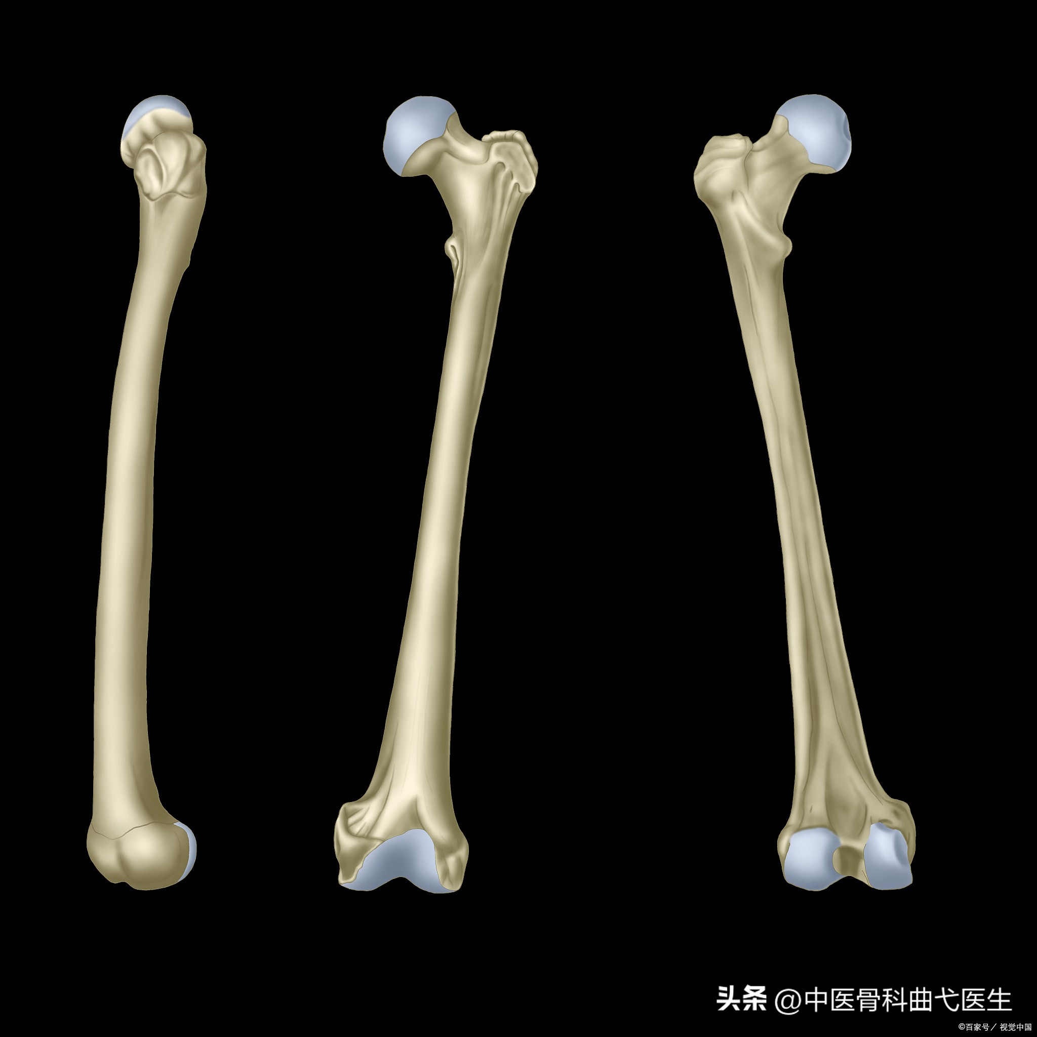 股骨头坏死早期症状花多少钱,髋关节股骨头坏死的早期症状