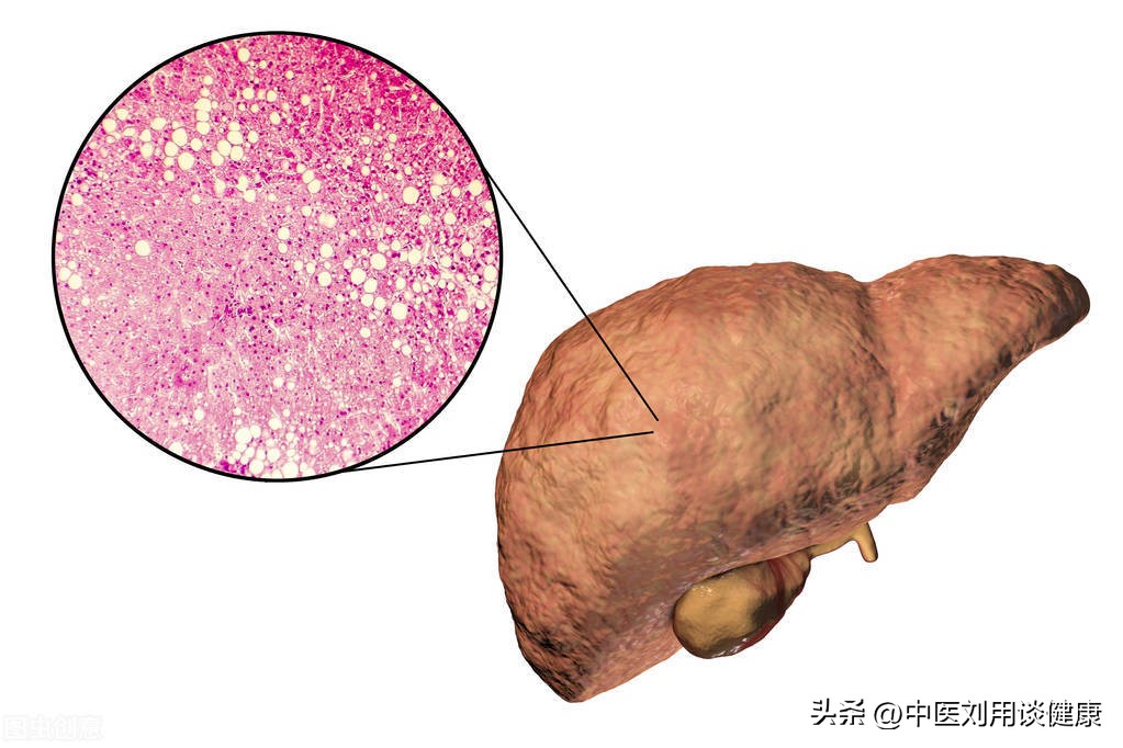 气血不足教你三招,气血不足百病生常吃四种食物