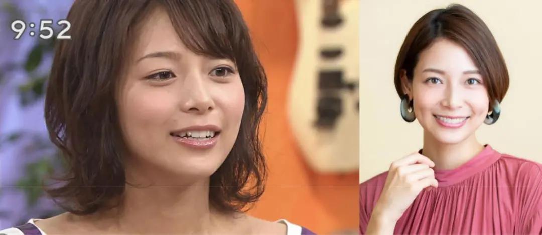 日本整牙的明星,日本整牙明星