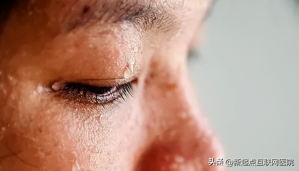 爱出汗和不爱出汗的人谁更健康呢,一动出汗和半天不出汗哪个更健康