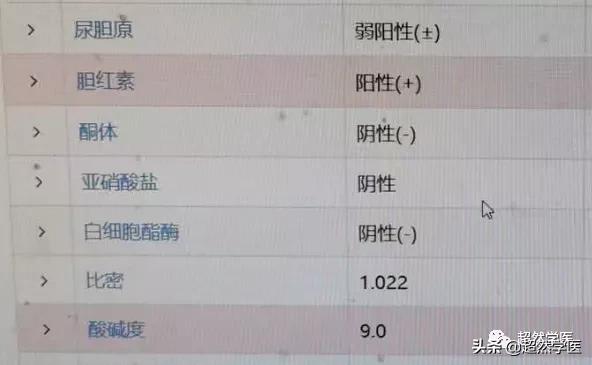 尿常规中的尿胆原代表什么,尿常规尿胆原和隐血有问题