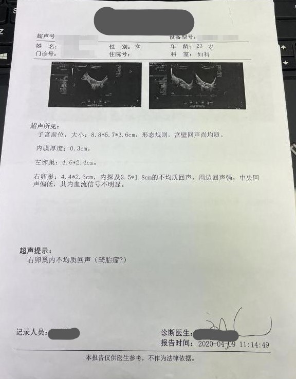 未婚女得卵巢畸胎瘤正常吗,未婚女性得了畸胎瘤怎么办