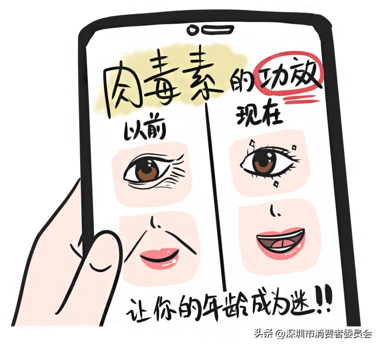 打完肉毒素以后不打会更显老吗,打完肉毒素皱纹变少了