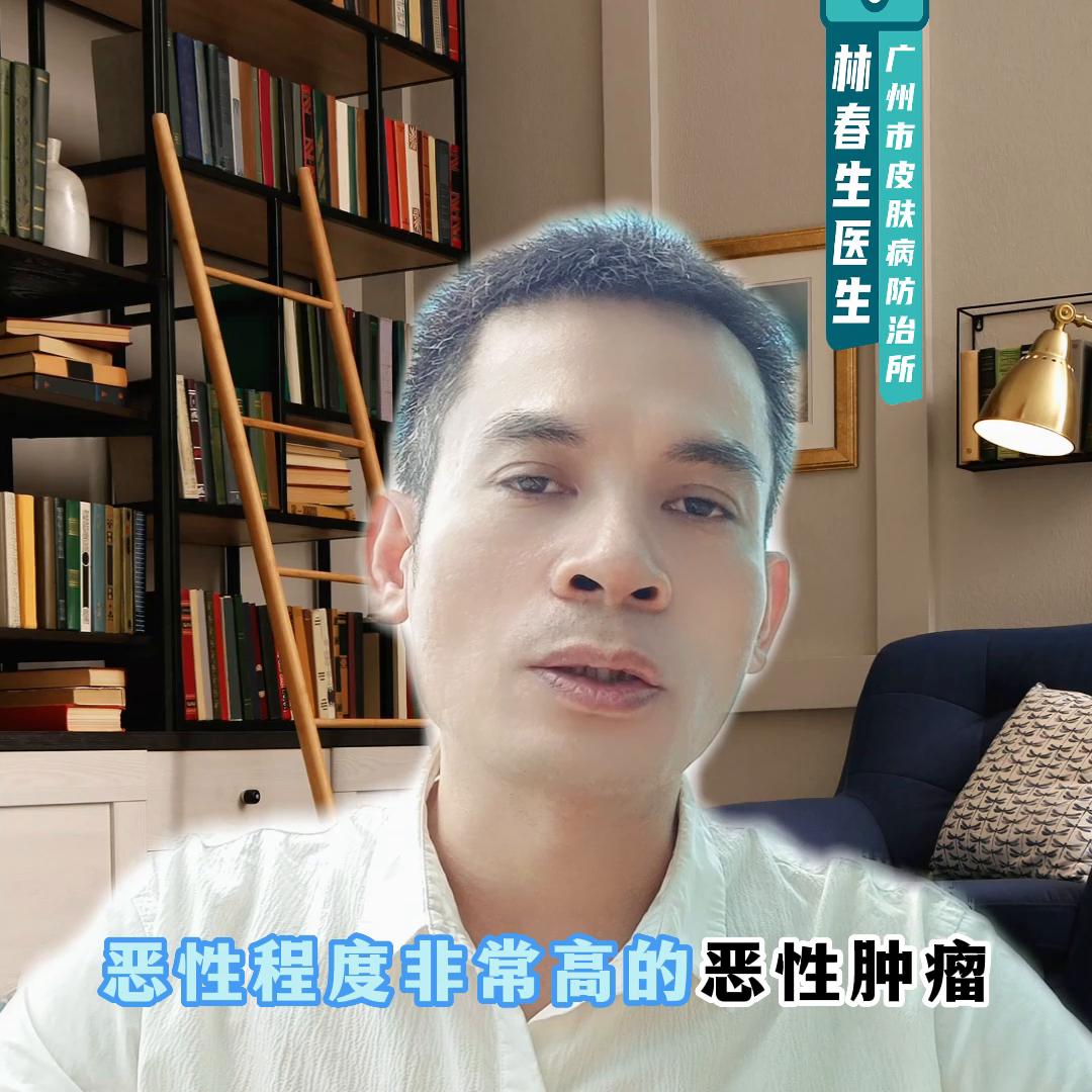 黑色素瘤是一个痣还是很多痣,黑色素瘤和普通的痣有什么区别