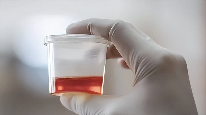 尿路感染反复发作去哪里就医,发现有尿路感染吃什么药好