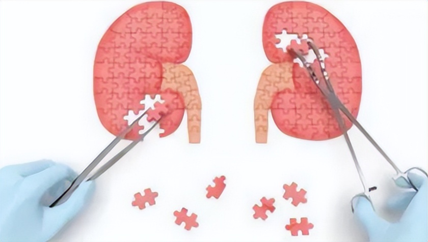 劣质化妆品对肾脏有没有影响,化妆品中毒导致肾病能自愈吗