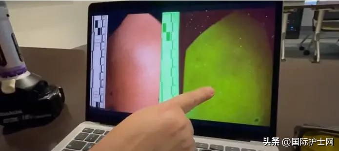 美国护士护理操作,美国护士发明28件实用神器