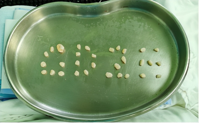 脚踝轻微扭伤如何处理,脚踝轻微扭伤用什么药物