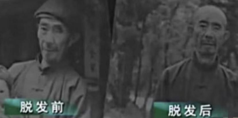 贵州农村发现鬼剃头,走近科学鬼剃头